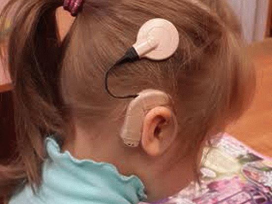 Уникальные операции позволяют глухим детям узнать, как звучит мир